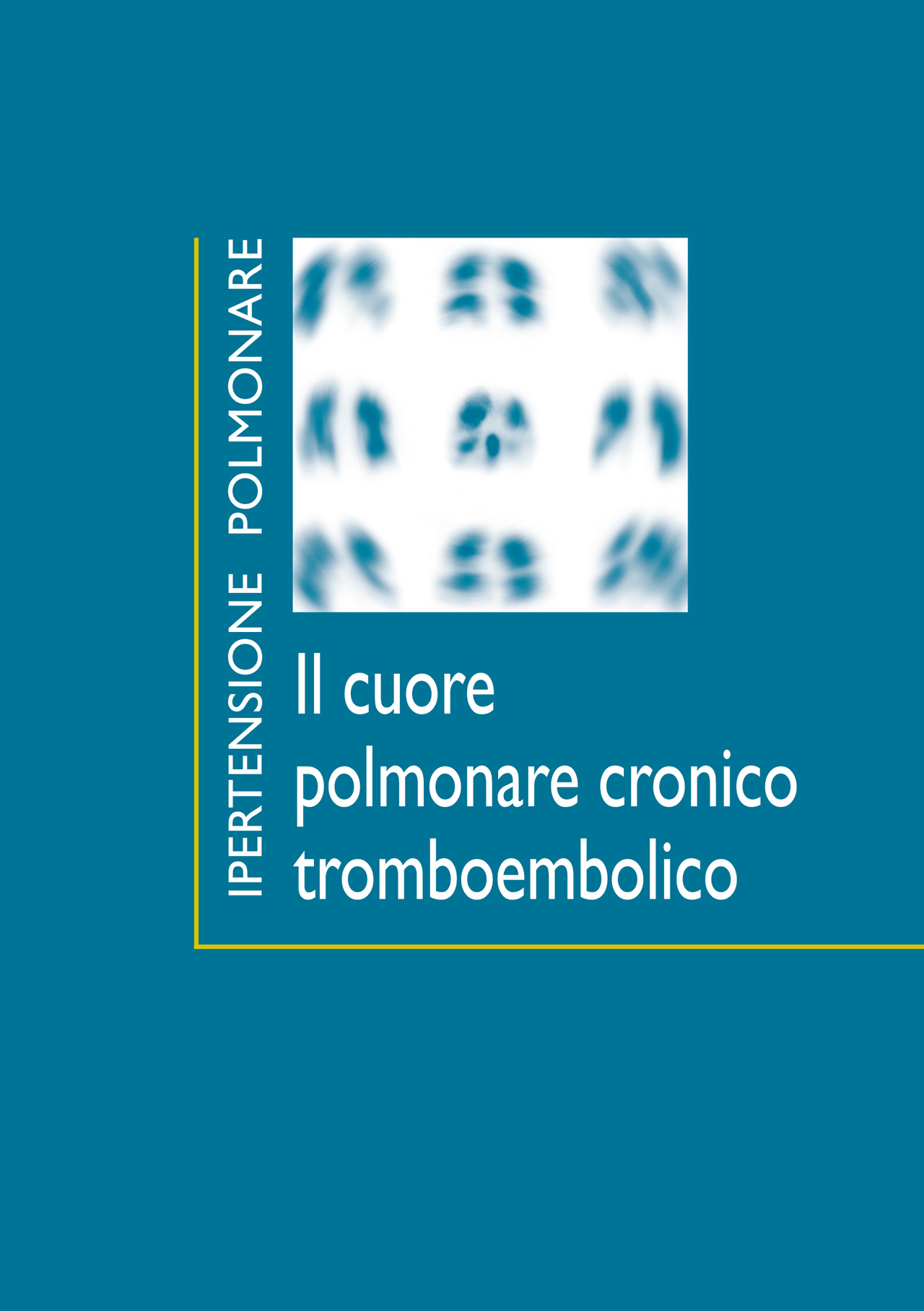 È disponibile il manuale “Il cuore polmonare cronico tromboembolico”