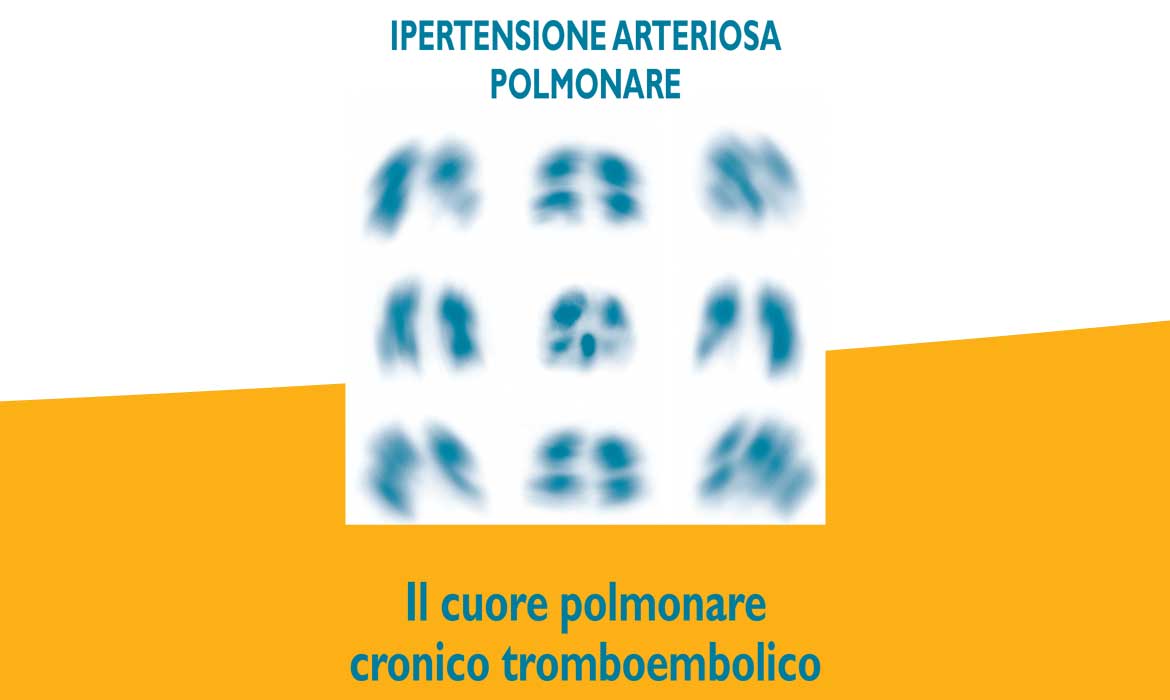 Il cuore polmonare cronico tromboembolico